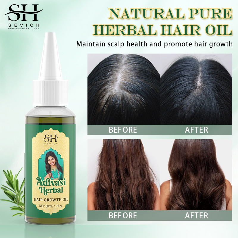 Ayurvedic Hair Growth Oil Adiv - Coconut Oil Refined บทวิจารณ์และราคา